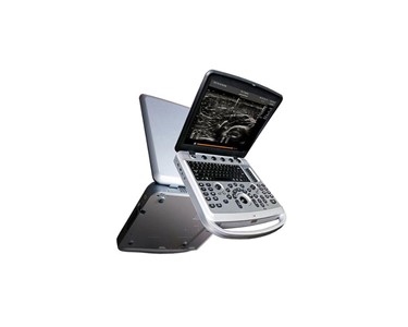 Ultrasound System for Vets Chison SonoBook 6