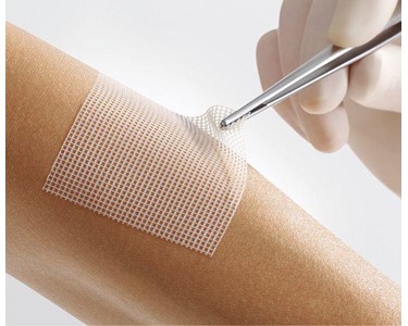 Lohmann & Rauscher - Wound Bandage | Lomatuell Pro