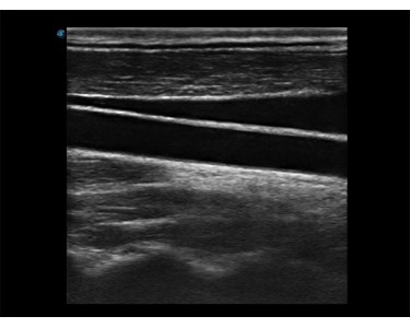 SonoScape - E1 B/W Portable Ultrasound