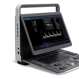 E1 B/W Portable Ultrasound