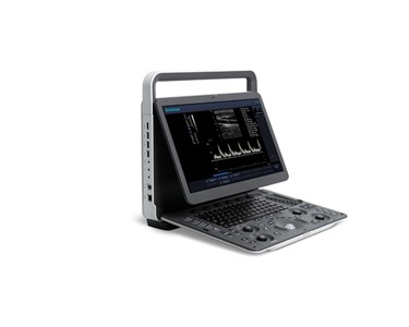 SonoScape - E1 B/W Portable Ultrasound