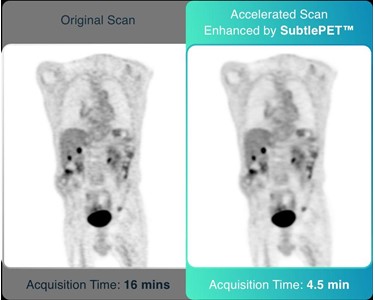 Subtle Medical - SubtlePET™ - AI Software