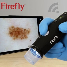 Wireless Digital Video Dermatoscope 