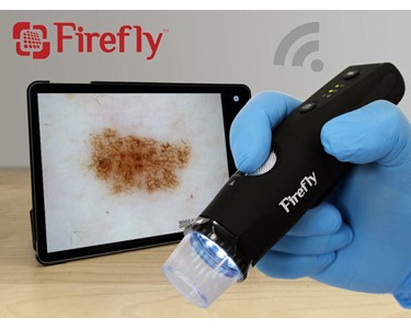 Firefly - Wireless Digital Video Dermatoscope 