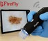 Firefly - Wireless Digital Video Dermatoscope 