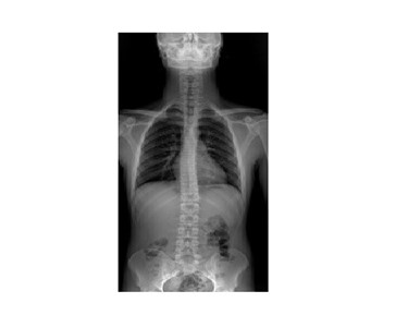 DRGEM - X-ray Machines | Chiropractors