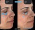 Cherry Imaging - Skin Analyser | Cherry 3D Skin Imaging