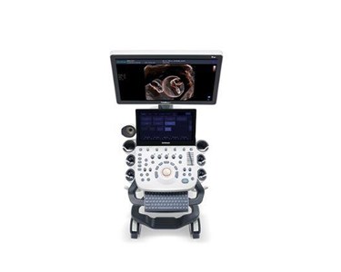 SonoScape - P20 Trolley Color Doppler Ultrasound System
