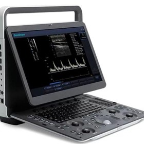 E1  Portable B&W Ultrasound Scanner