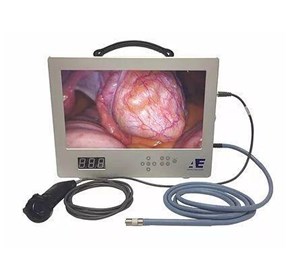 All-in-One Medical Portable Video Endoscopic System (AE-1080 HD)