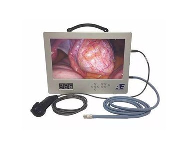 All-in-One Medical Portable Video Endoscopic System (AE-1080 HD)