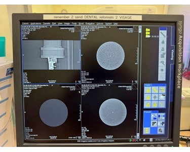 Siemens - Somatom Perspective 16 Slice [CT Scanner] [EX4371]