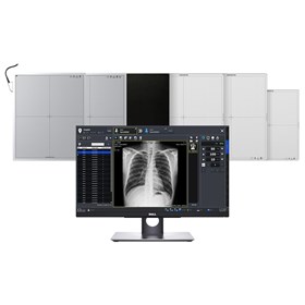 Vieworks DR detector