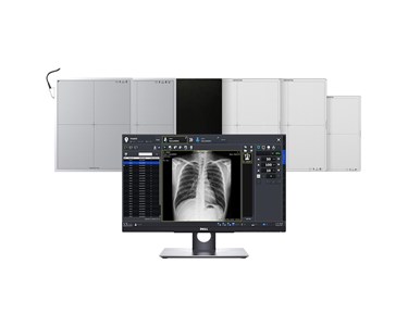 Vieworks DR detector
