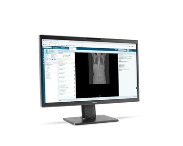 Barco - Clinical Review Displays