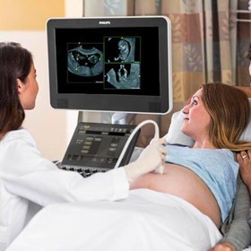 Philips highlights FetView cloud-based image sharing and reporting software for obstetrics and gynecology at ISUOG 2022