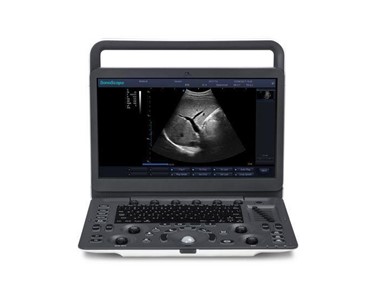 Sonoscape E1 Ultrasound Unit