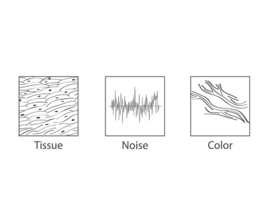 SonoScape - P15 Trolley Color Doppler Ultrasound System