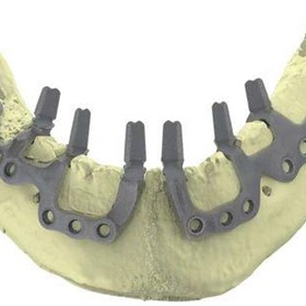 Dental Implant  | IUXTA 