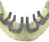 Dental Implant  | IUXTA 