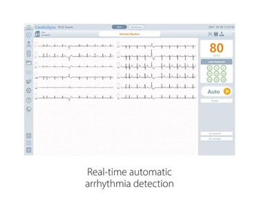 Bionet - Cardio P1 PC-Based ECG with Interpretation