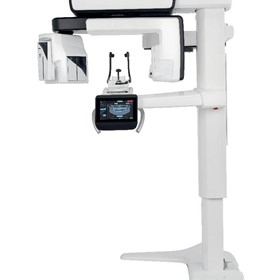 Is CBCT a better option than just an OPG?
