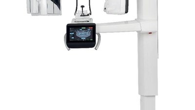 Is CBCT a better option than just an OPG?