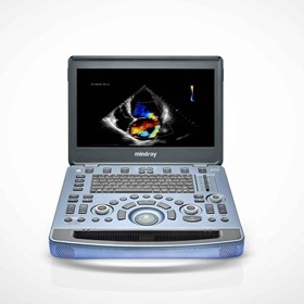 Portable Veterinary Ultrasound Machine | Vetus M11