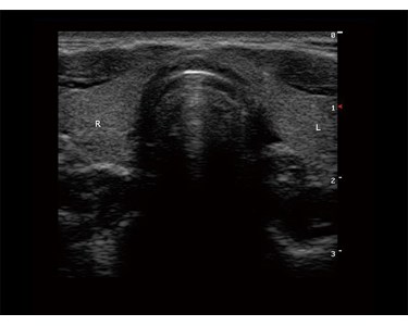 SonoScape - S9 Portable Color Doppler Ultrasound System