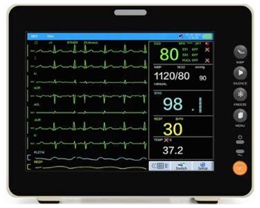 Floline - Floline Pocket Multi-parameter Veterinary Patient Monitor