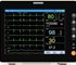 Floline - Floline Pocket Multi-parameter Veterinary Patient Monitor