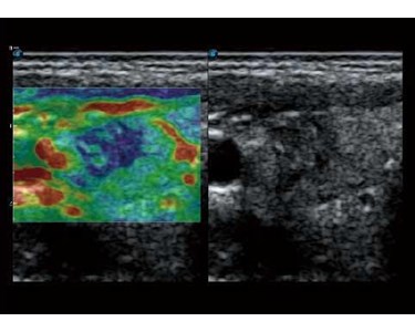 SonoScape - P50 Trolley Color Doppler Ultrasound System