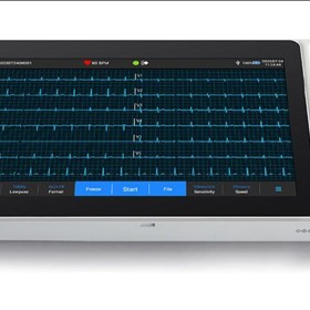 ECG Machine - NeoECG S120 Electrocardiograph