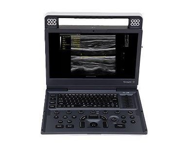 SIUI - Portable Ultrasound System | Apogee C1 