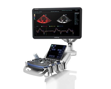Portable Vet Ultrasound Machine | Vetus 8