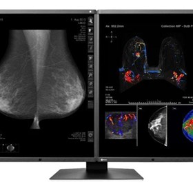 5MP Colour Diagnostic Monitor | RadiForce RX560 Dual Monitor Setup