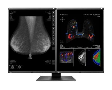 Eizo - 5MP Colour Diagnostic Monitor | RadiForce RX560 Dual Monitor Setup