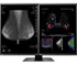 Eizo - 5MP Colour Diagnostic Monitor | RadiForce RX560 Dual Monitor Setup