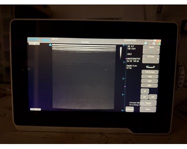 Terason - u3200T Ultrasound