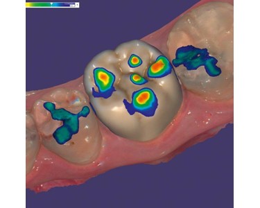 ExoCad - Chairside CAD software