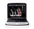 Chison Ultrasound Scanner Colour Doppler, Laptop | SonoBook