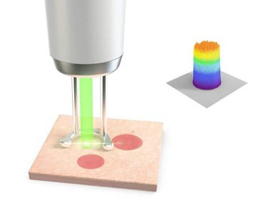 Quanta System - Cosmetic Lasers | Pigmentation Laser | Q-Plus A EVO