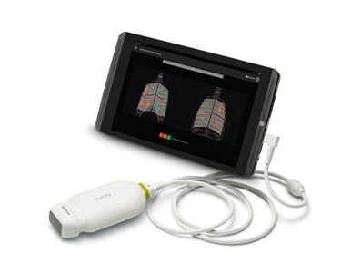 Philips - Premium Portable ultrasound