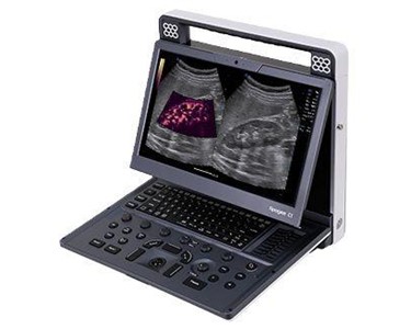 SIUI - Portable Ultrasound System | Apogee C1 