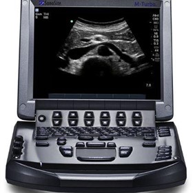 Sonosite M-Turbo | Portable Ultrasound System