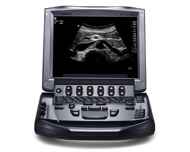 Sonosite M-Turbo | Portable Ultrasound System