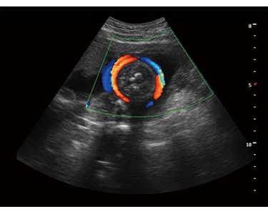 SonoScape - S9 Portable Color Doppler Ultrasound System