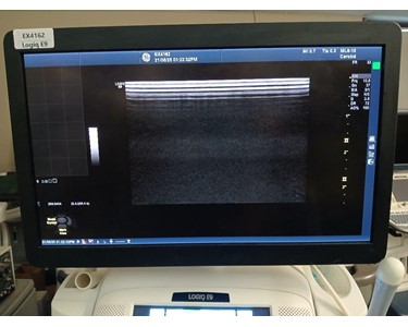GE - Logiq E9 Ultrasound