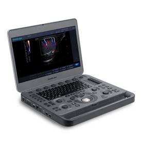 Portable Ultrasound Machine | X3