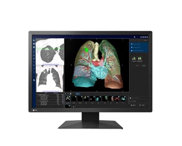 Eizo RadiForce MX243W 24.1" 2MP Clinical Review Monitor, Black